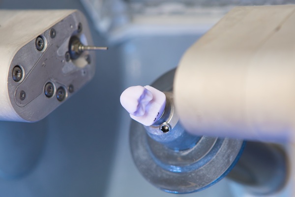 How CEREC Is Used For Dental Restorations