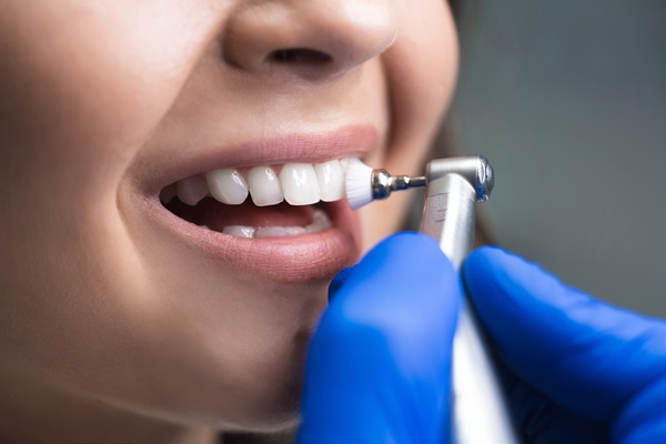 What To Ask Your Dentist About A Dental Cleaning