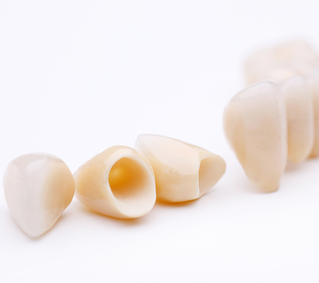 Prescott Dental Crowns and Dental Bridges