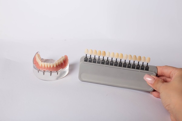 The Advantages Of Implant Supported Dentures Over Regular Ones