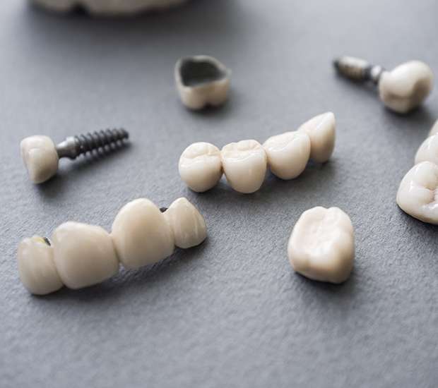 Prescott The Difference Between Dental Implants and Mini Dental Implants