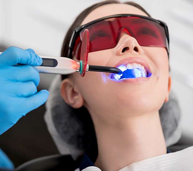 Prescott Professional Teeth Whitening